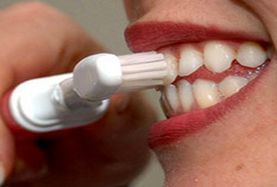 Dişeti Hastalıkları Tedavisi